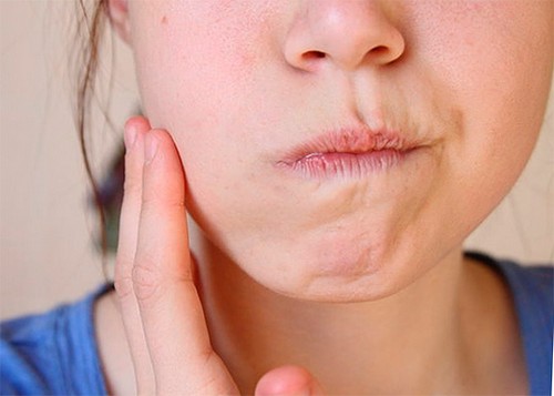 Рецепт спасения от зубной боли - правильное использование соды